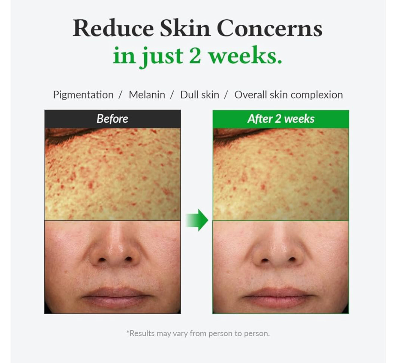 Dr.Althea Gentle Vitamin C Serum (7966629658671)